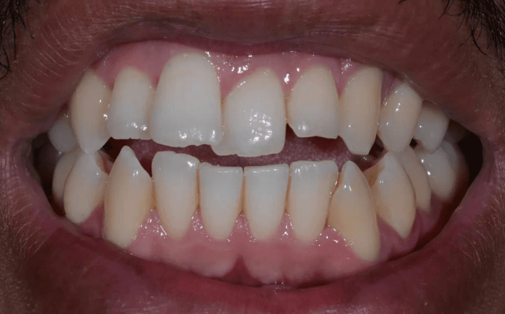 Adam before treatment