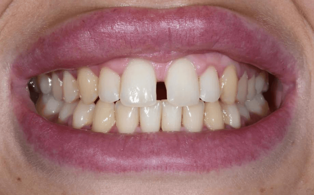 Poppy before treatment