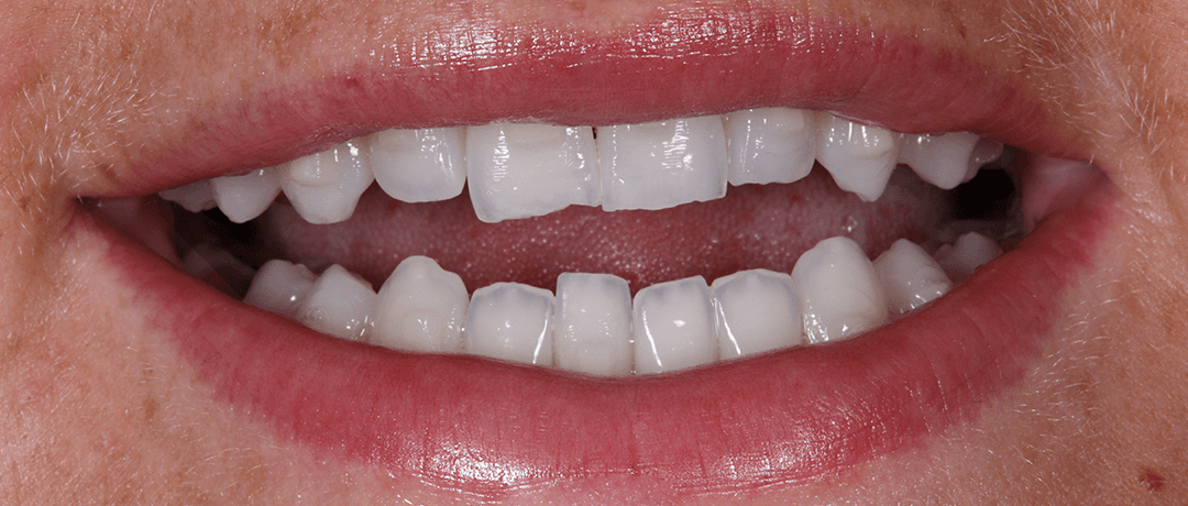 Katie before treatment