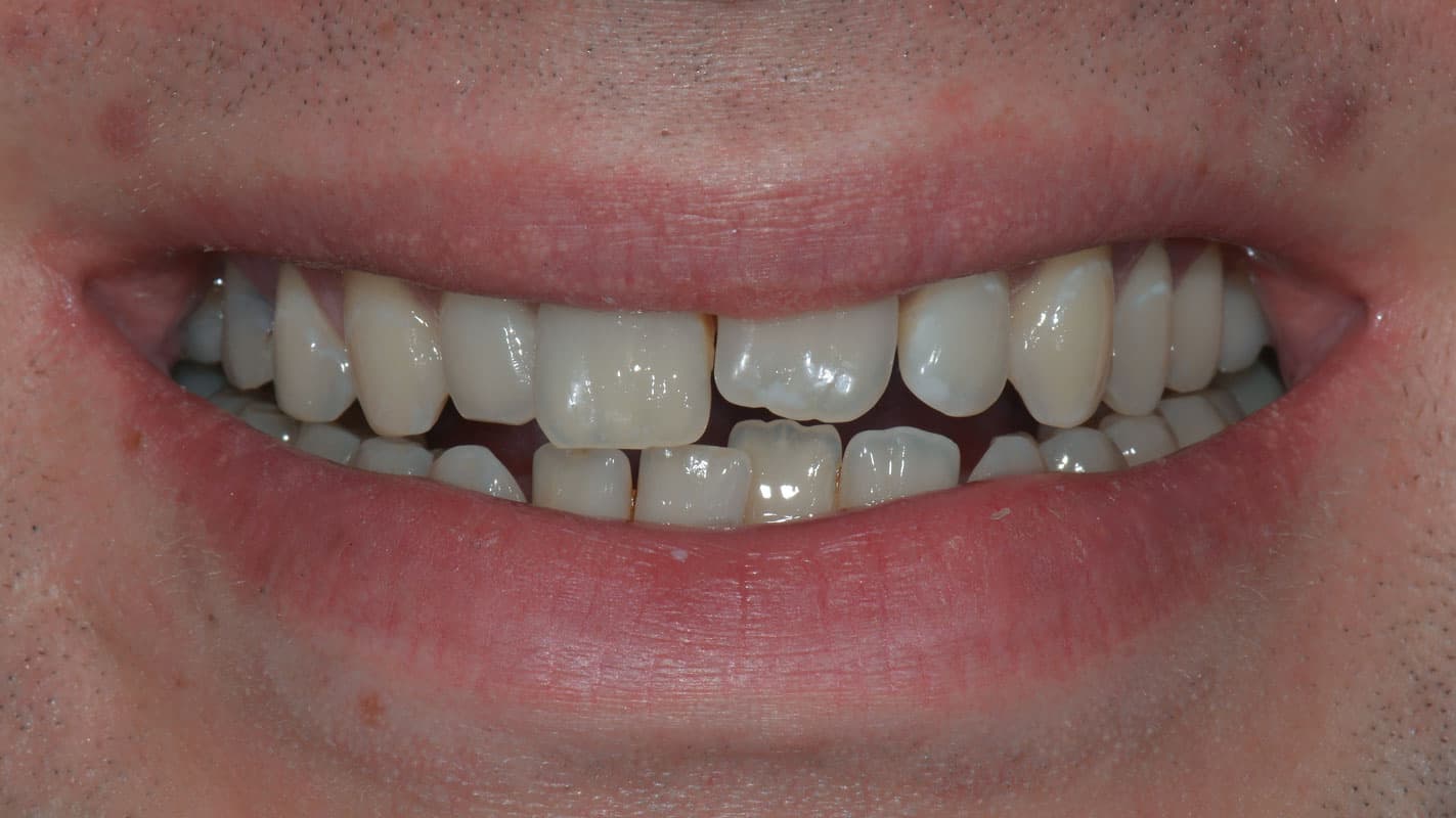 David before treatment